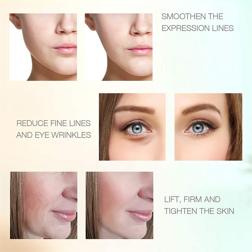 RF Radio Frequency Skin Tightening Device J877628
